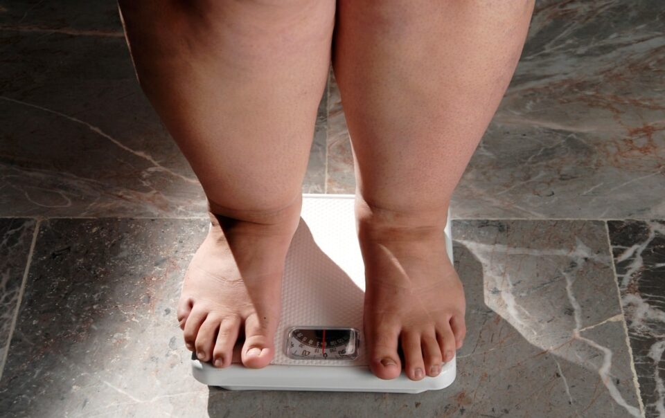 morbid-obesity:-causes,-treatment-and-more-healthifyme